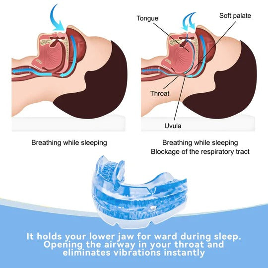 Adjustable Anti-Snoring Mouthpiece – Comfortable Sleep Guard - Image 3
