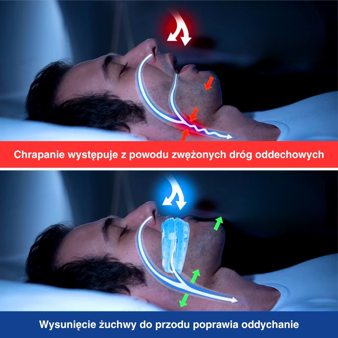Adjustable Anti-Snoring Mouthpiece – Comfortable Sleep Guard - Image 4